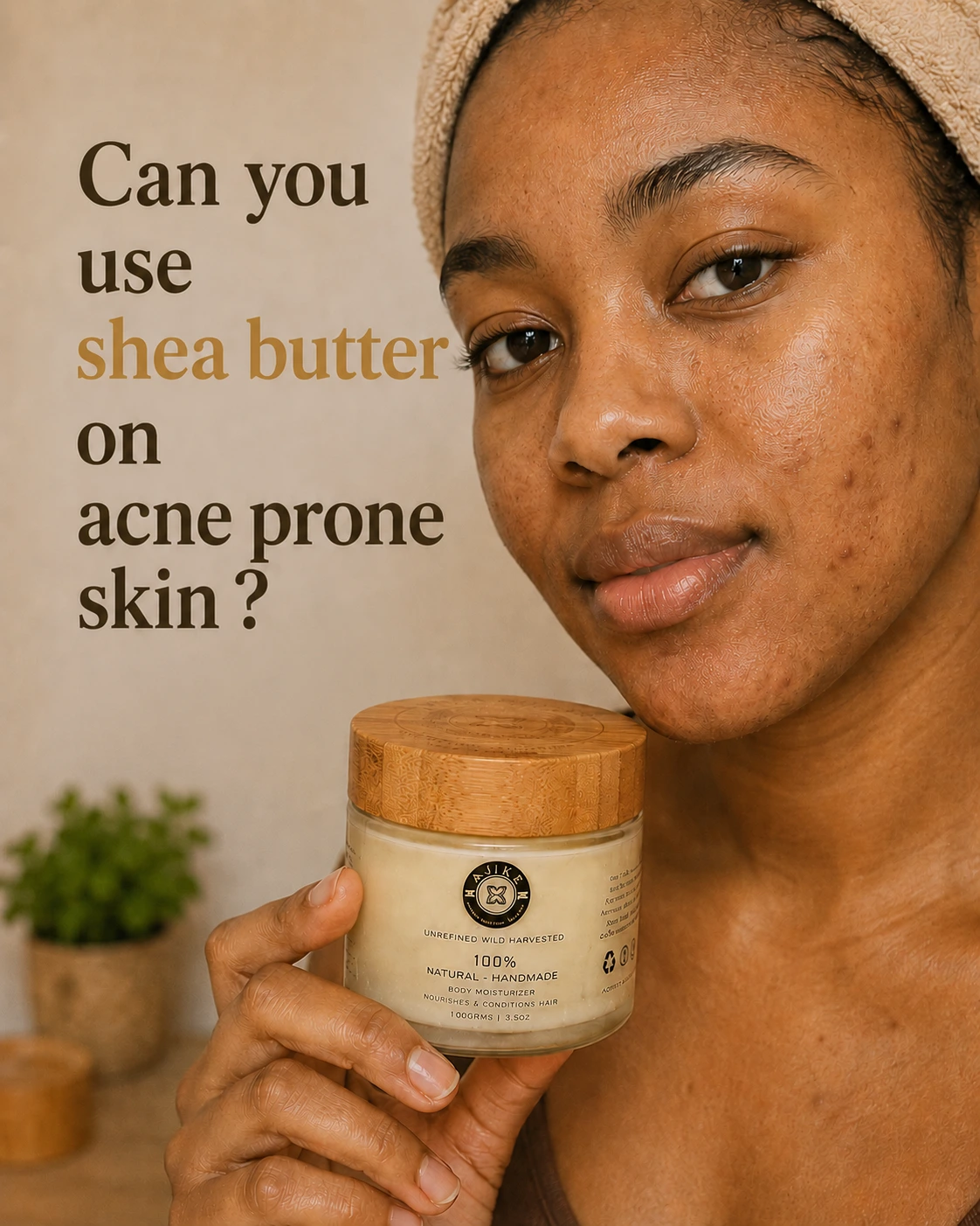 Can You Use Shea Butter on Acne - Prone Skin?