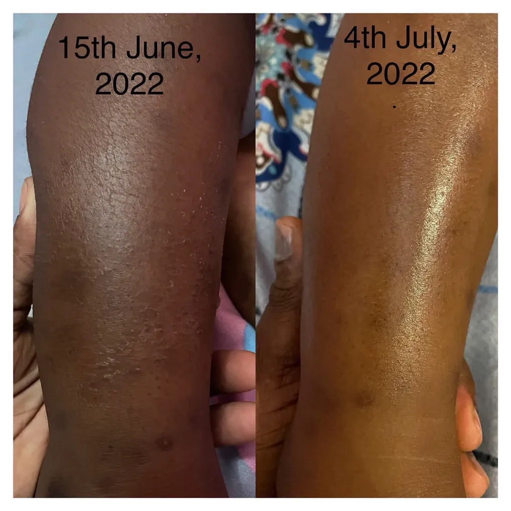 SKIN BARRIER REPAIR 6.webp