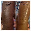 SKIN BARRIER REPAIR 6.webp