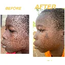 AJIKE ECZEMA RELIEF 4.webp