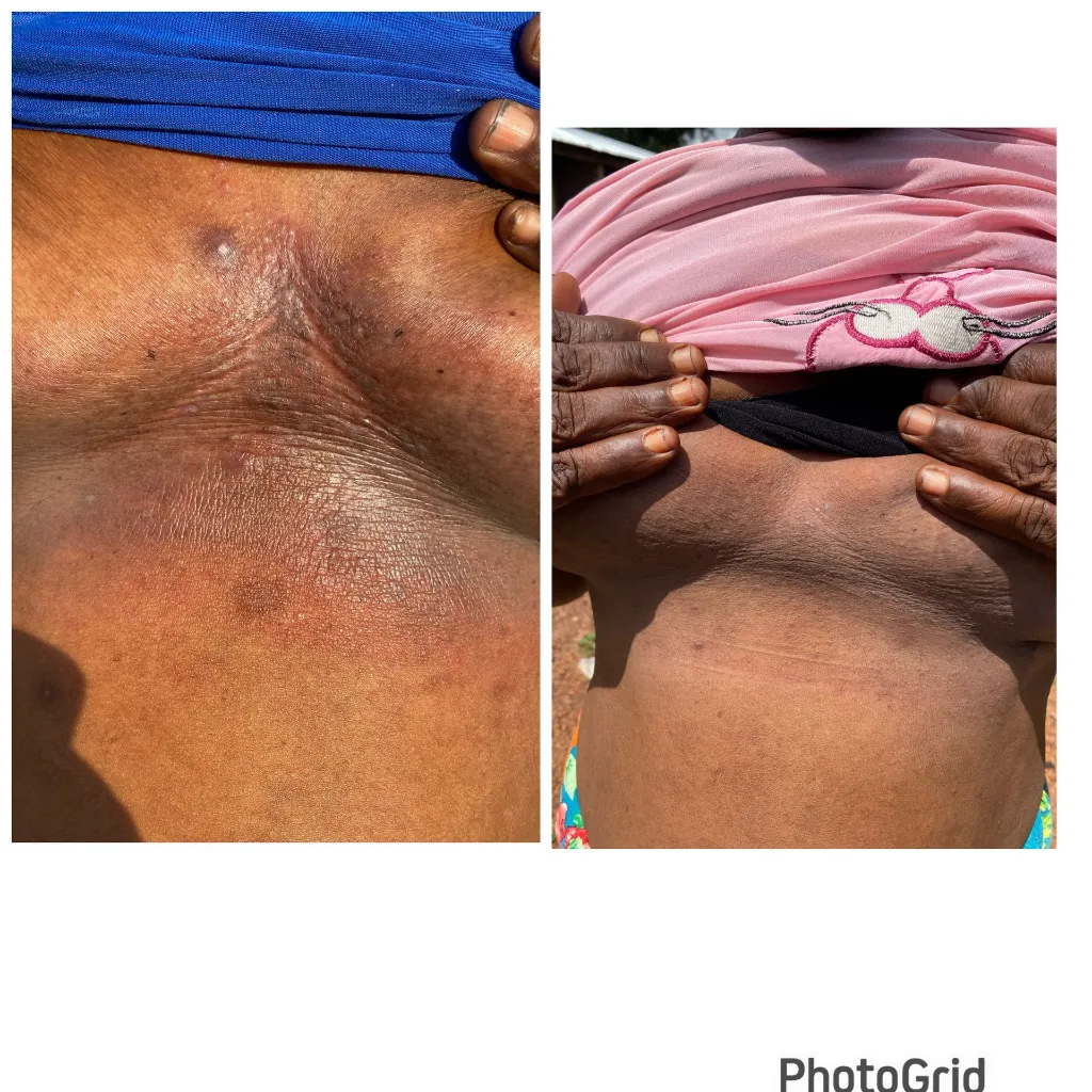 AJIKE ECZEMA RELIEF.webp