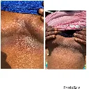 AJIKE ECZEMA RELIEF.webp